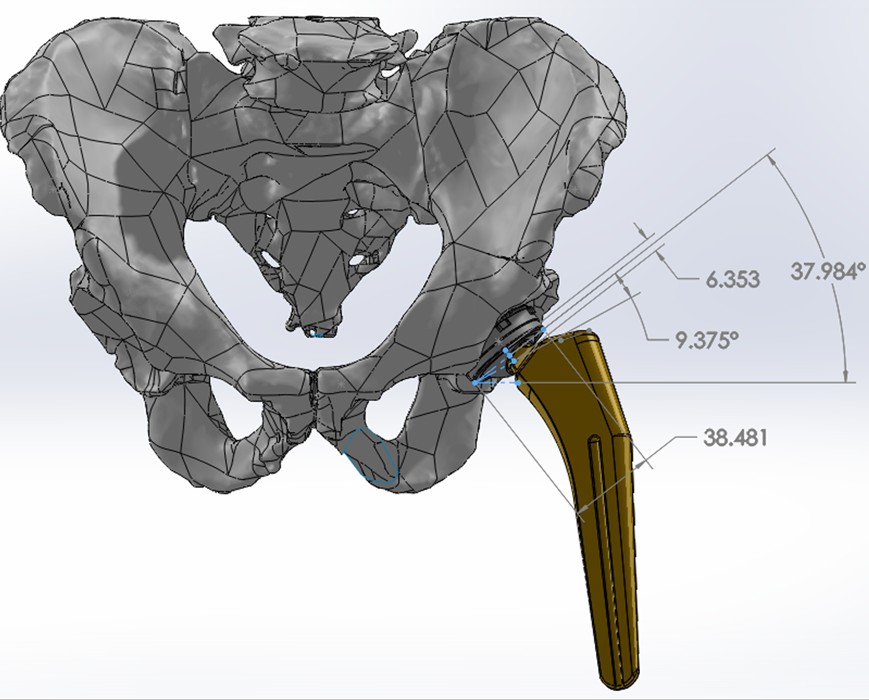 Design and Development 3D model of pelvis and hip